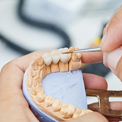 closeup of hands creating a dental bridge